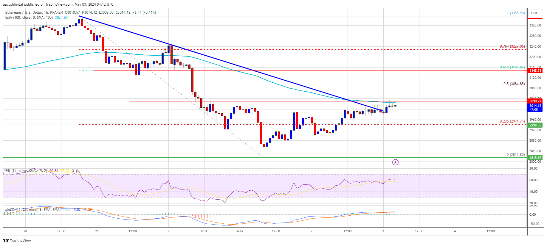 Ethereum Price Could Rally If It’s Able To Reclaims The 100 SMA