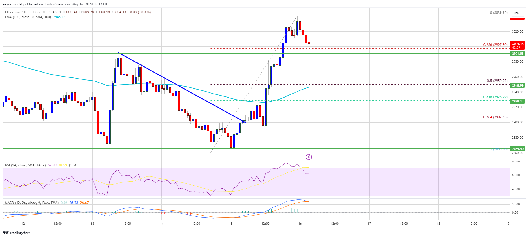 Ethereum Price Recovery Trails Behind Bitcoin’s Surge in Crypto Rebound